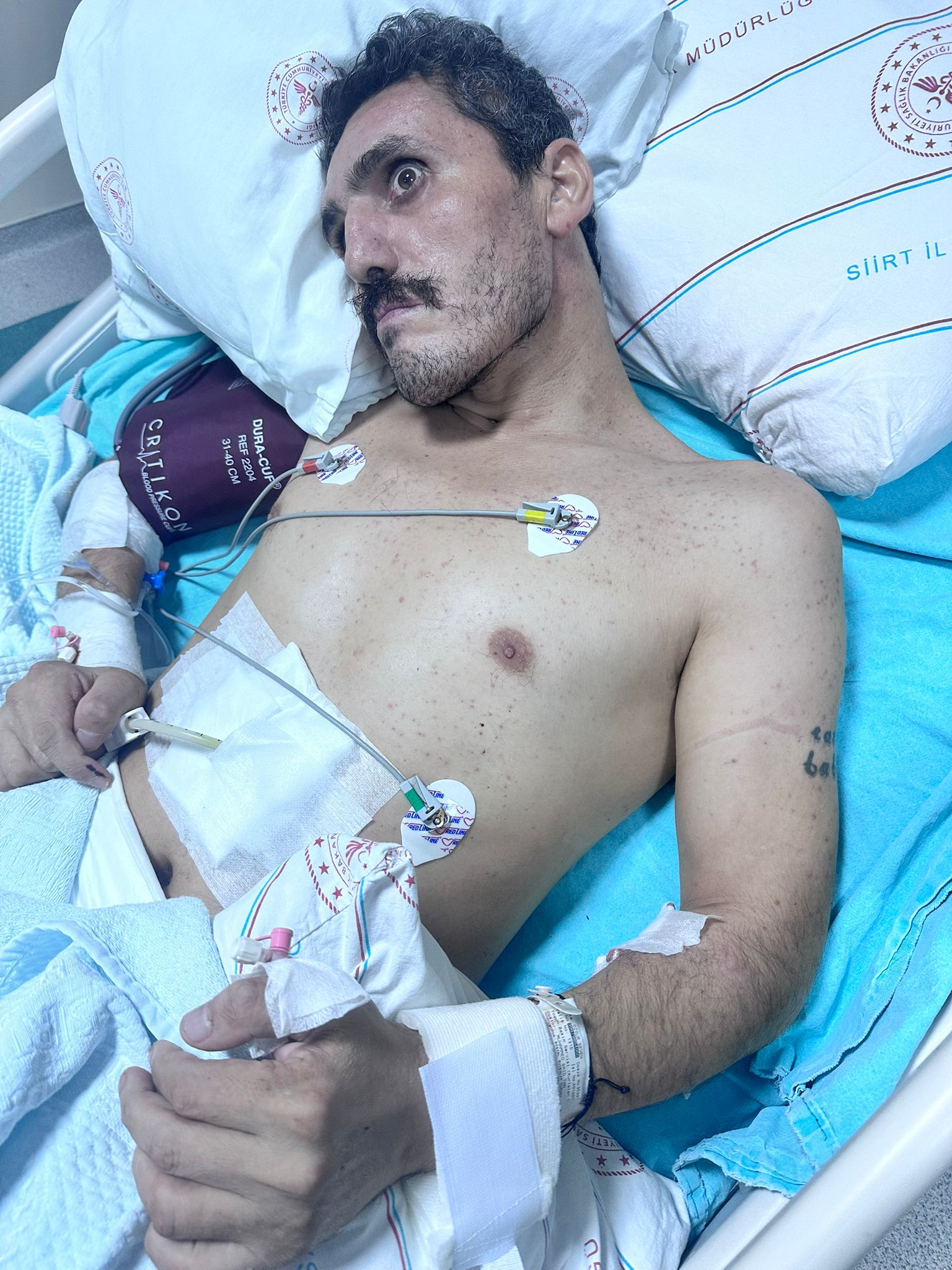 Vicdanları Yaralayan Olay Yoğun Bakımdaki Engelli Vatandaş Tutuklandı4 (3)