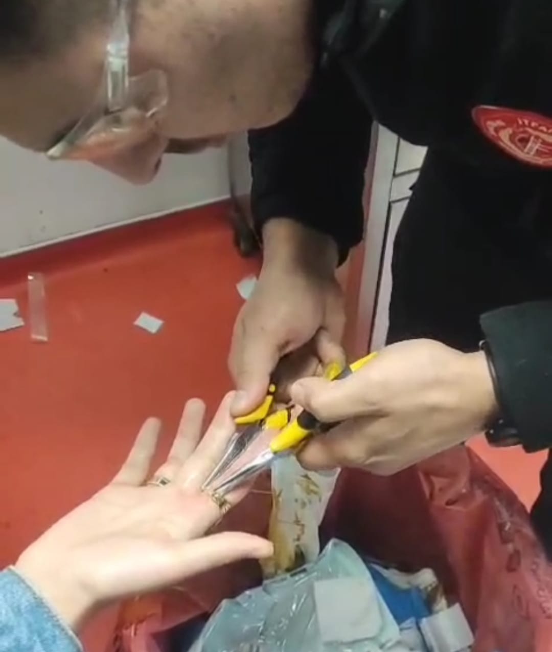 Yüzüğü Çıkaramayınca İtfaiye Yetişti (1)