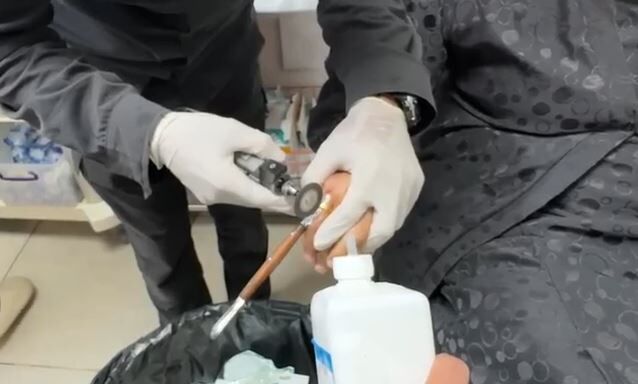 İluh Devlet Hastanesi’nde Parmağına Yüzük Sıkışan Ninenin İmdadına İtfaiye Yetişti (1)