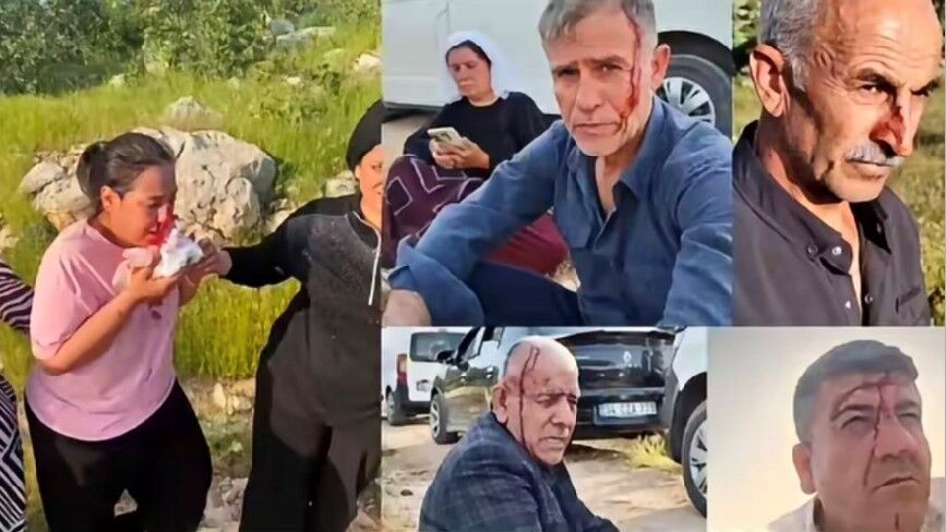 Şırnak'ta Batmanlı Aileye Taşlı Sopalı Saldırı: 7 Yaralı, 11 Gözaltı