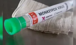 ABD'de Mpox'un yeni varyantından ilk vaka tespit edildi