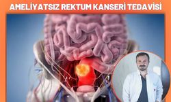 Ameliyatsız Rektum Kanseri Tedavisi