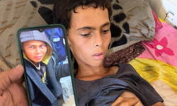 Gazze'de kıtlık nedeniyle bir çocuk daha hayatını kaybetti