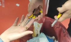Yüzüğü Çıkaramayınca İtfaiye Yetişti