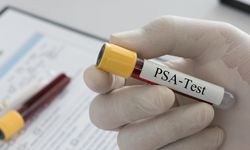 Prostat kanseri çoğu zaman belirti vermeden ilerler