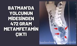 Batman’da Yolcunun Midesinden 472 Gram Metamfetamin Çıktı