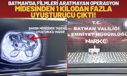 Batman'da Filmleri Aratmayan Operasyon: Midesinden 1 Kilodan Fazla Uyuşturucu Çıktı!