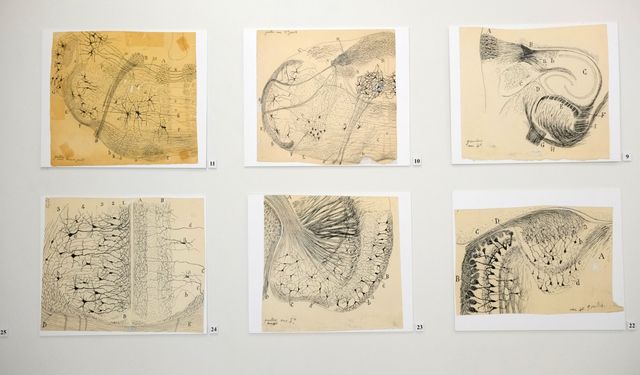 Migrenin kökeni aydınlanıyor: NÖROM’dan bağırsak–beyin eksenini gösteren çarpıcı bulgular