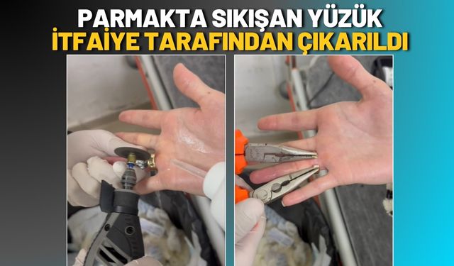 Parmakta Sıkışan Yüzük İtfaiye Tarafından Çıkarıldı