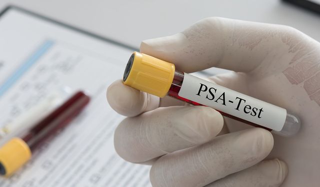 Prostat kanseri çoğu zaman belirti vermeden ilerler