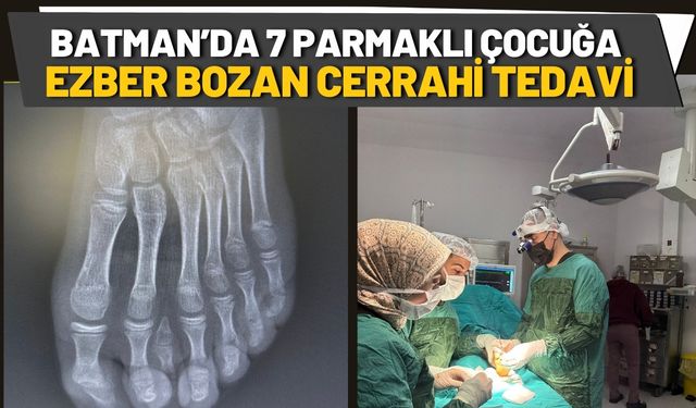Batman’da 7 Parmaklı Çocuğa Ezber Bozan Cerrahi Tedavi