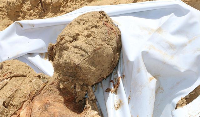 Siyonist rejim 'en büyük deri bankası bizde' dedi: Bu deriler nereden geldi?