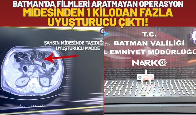 Batman'da Filmleri Aratmayan Operasyon: Midesinden 1 Kilodan Fazla Uyuşturucu Çıktı!