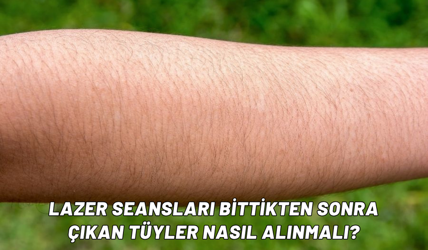 Lazer seansları bittikten sonra çıkan tüyler nasıl alınmalı?