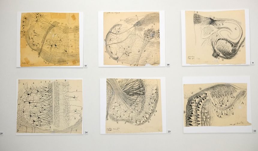 Migrenin kökeni aydınlanıyor: NÖROM’dan bağırsak–beyin eksenini gösteren çarpıcı bulgular