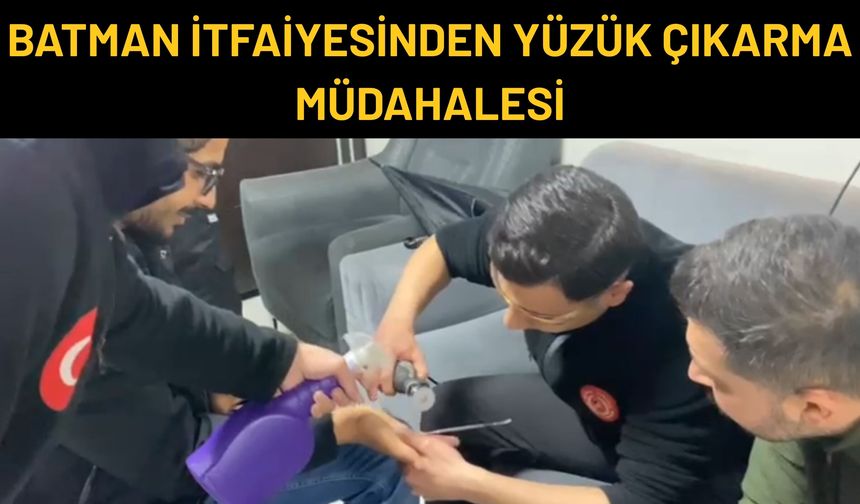 Batman İtfaiyesinden Yüzük Çıkarma Müdahalesi