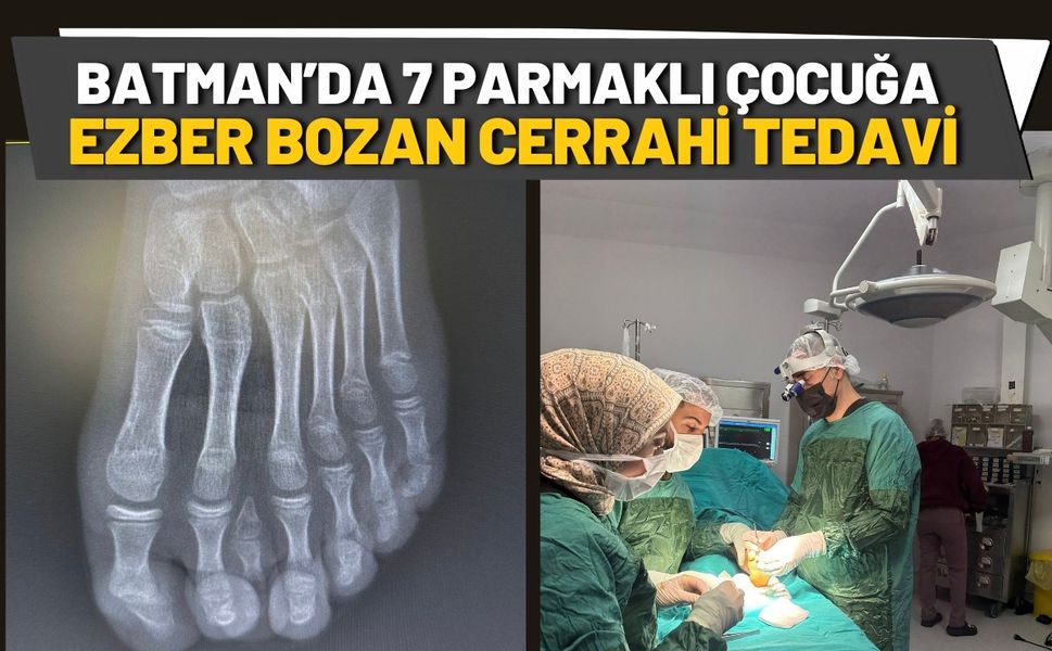 Batman’da 7 Parmaklı Çocuğa Ezber Bozan Cerrahi Tedavi