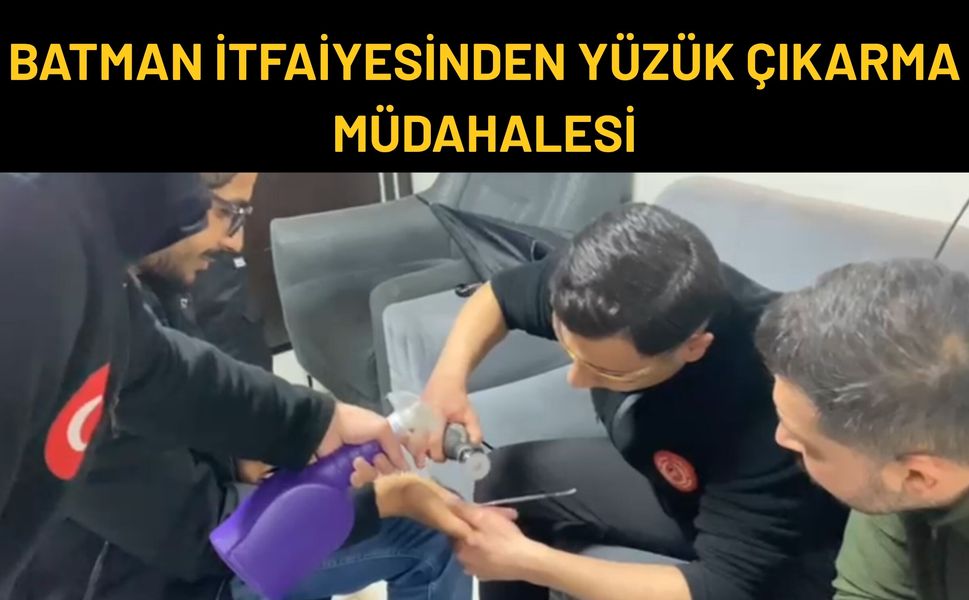 Batman İtfaiyesinden Yüzük Çıkarma Müdahalesi