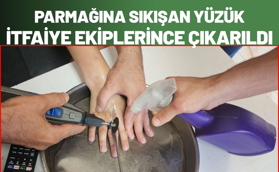 Parmağına Sıkışan Yüzük İtfaiye Ekiplerince Çıkarıldı