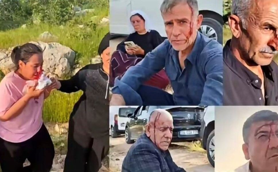 Şırnak'ta Batmanlı Aileye Taşlı Sopalı Saldırı: 7 Yaralı, 11 Gözaltı