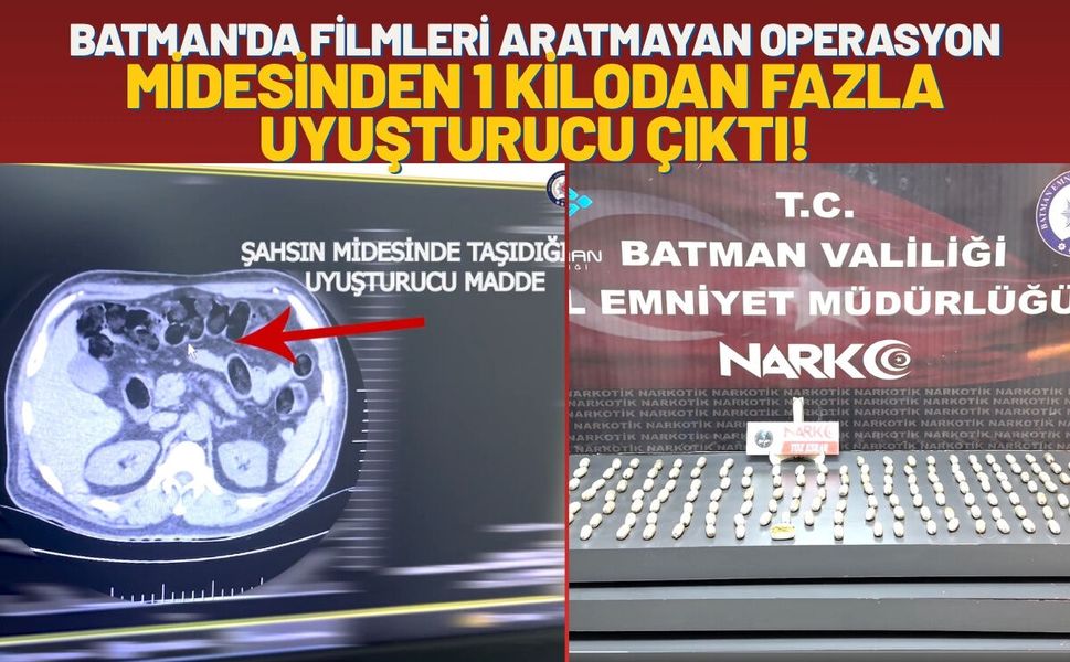 Batman'da Filmleri Aratmayan Operasyon: Midesinden 1 Kilodan Fazla Uyuşturucu Çıktı!